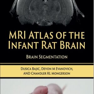 MRI Atlas of the Infant Rat Brain: Brain Segmentation