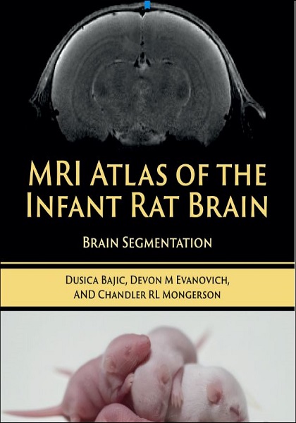 MRI Atlas of the Infant Rat Brain: Brain Segmentation