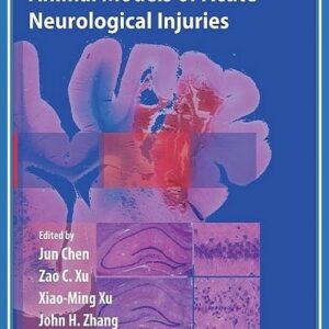 Animal Models of Acute Neurological Injuries