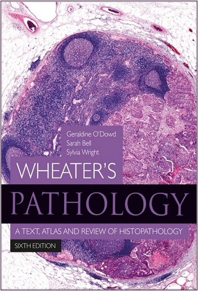 Wheater’s Pathology: A Text, Atlas and Review of Histopathology, 6th Edition
