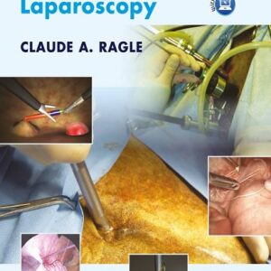 Advances in Equine Laparoscopy