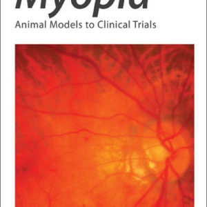 Myopia: Animal Models to Clinical Trials
