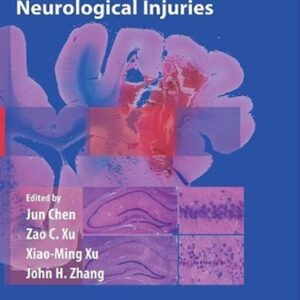 Animal Models of Acute Neurological Injuries