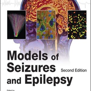 Models of Seizures and Epilepsy, 2nd Edition